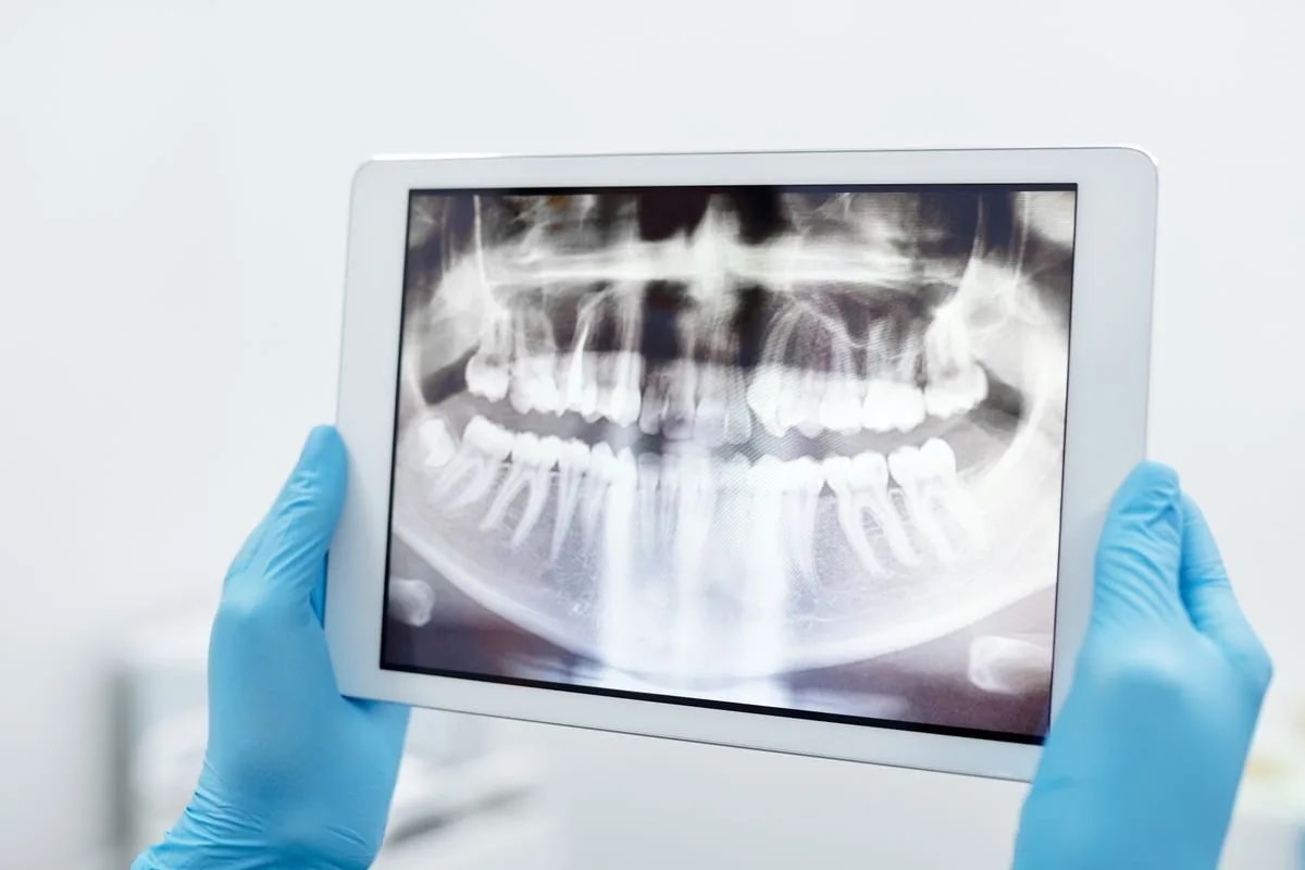 Diş röntgeninin tablet üzerinden değerlendirilmesi — hassasiyetin nedenini saptama