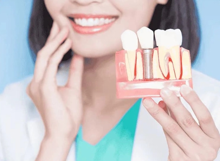 Hekim, çene kemiğine yerleşen implant vidasını gösteren kesit maketini tutuyor