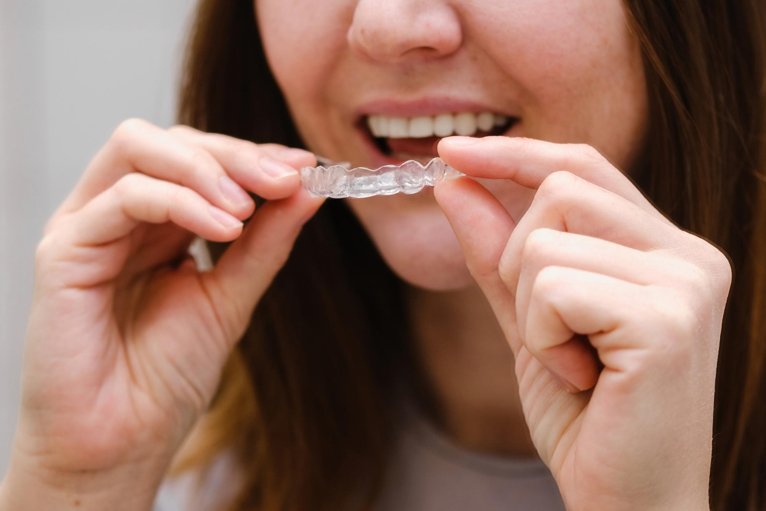 Şeffaf Plak Tedavisini Ortodontist Gamze Yazıcı ile Doğru Yönetmek