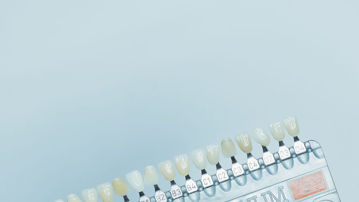 Diş rengi belirleme skalası (ton kartı) — Diş Beyazlatma: Sık Sorulan Sorular ve Uzman Yanıtları | Mimar Diş Ağız ve Diş Sağlığı Polikliniği, Mimaroba/Büyükçekmece