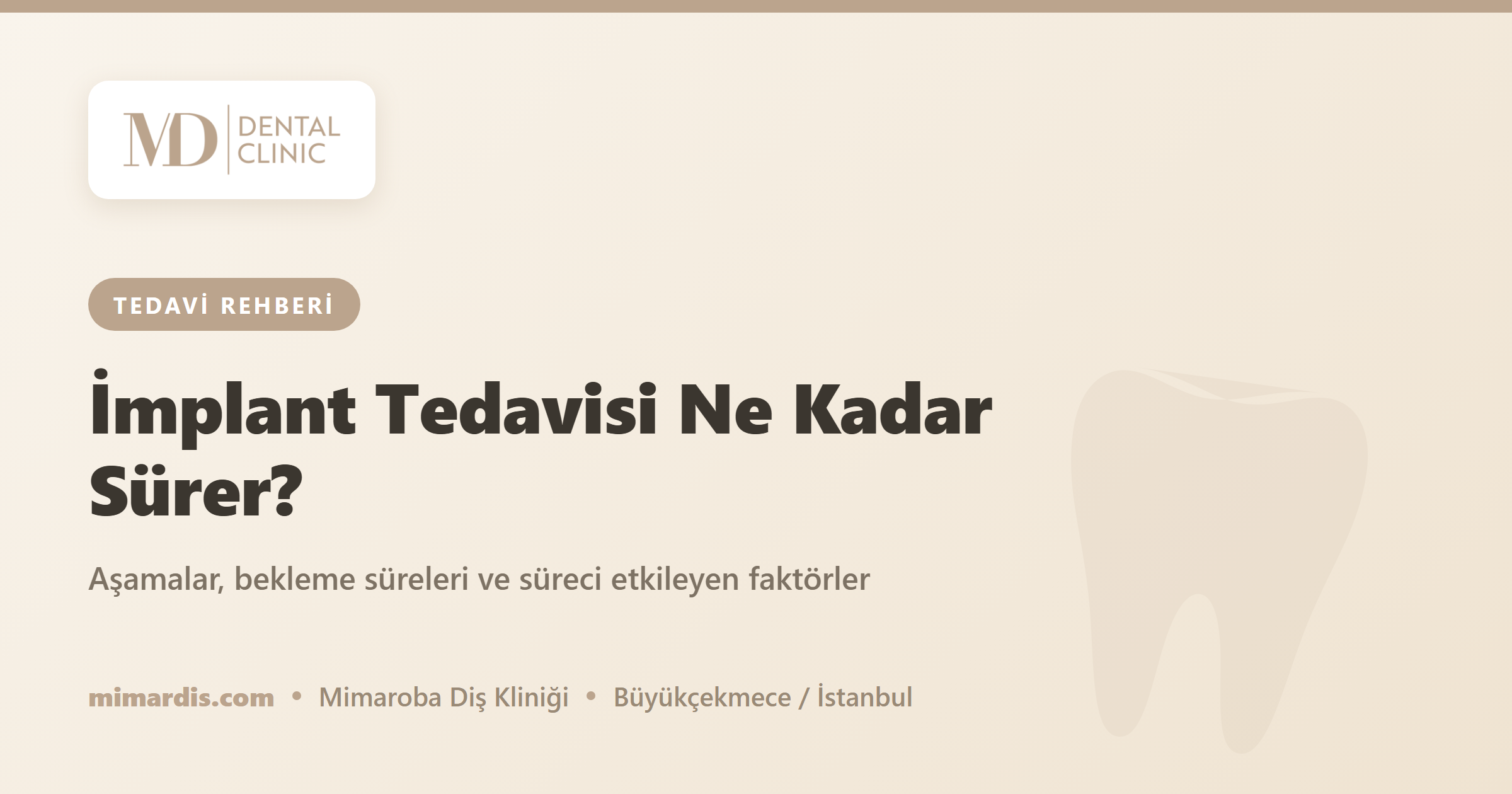 İmplant Tedavisi Ne Kadar Sürer? - Mimar Diş Ağız ve Diş Sağlığı Polikliniği, Mimaroba/Büyükçekmece