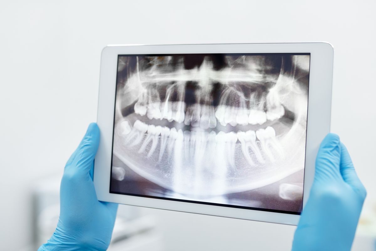 Diş röntgeninin tablet üzerinden değerlendirilmesi — hassasiyetin nedenini saptama
