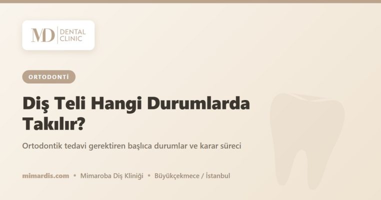 Diş Teli Hangi Durumlarda Takılır? – Mimar Diş Ağız ve Diş Sağlığı Polikliniği, Mimaroba/Büyükçekmece
